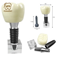 1PCS oversized implant crystal model dental tooth research model detachable crystal implant for teac
