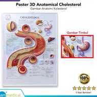 Poster Anatomical Cholesterol 3D BS 153RR/picture On Embossed poster
