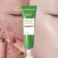 Acnes Cream Oil Control & Whitening Obat jerawat dan bekas jerawat penghilang salep obat paling ampu