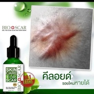 คีลอยด์ รักษาได้  Bioscarไบโอสการ์ ลบแผลเป็น ตุ่ม รอยสิว แผลเป็น น้ำเหลืองไม่ดี ผิวแพ้ง่ายใช้ได้ !!  ปรับผิวขาว เรียบเนียน ลบรอย  เข่าดำ ศอกดำ คอดำ ต้องใช้ เซรั่มเข้มข้น เห็นผลไว   หมายเลขใบอนุญาต/อย. 55-1-6500020182 วันหมดอายุ 15/2/2569