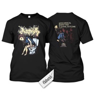 Short Sleeve - Inopexia - Myocardical Biopsy Had Lethal Outcomea