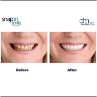 L14 Snap On Smile Gigi Palsu Instan Atas Bawah 100% ORI Perapi Gigi