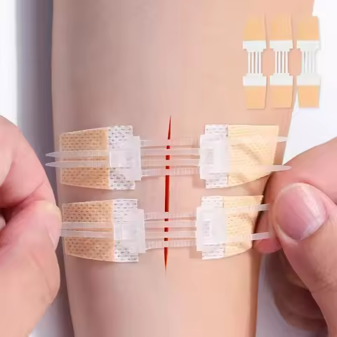 3pcs/set Band-Aid Zipper Tie Wound Closure Patch Hemostatic Patch Wound Fast Suture Zipper Band-Aid 
