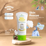 YummysBaby Skin Rescue Cream | Treat Sensitive & Irritated Skin | Moisturizes & Softens Baby's Skin