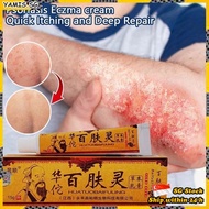 🍄𝗦𝗚 𝗦𝗧𝗢𝗖𝗞🍄 Huatuobaifuling Psoriasis ointment Eczema cream Itch relief herbal cream Antifungal Ringw