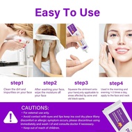 20g Azelaic Acid Niacinamide Face Cream Acne Relief and Even Tone Balancing Face Moisturizer for Sen