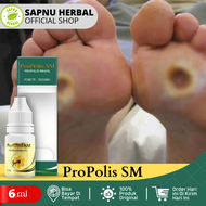 Obat Luka Diabetes Luka Diabetes Melitus Luka Diabetes Basah Luka Diabetes Kering Luka Gangren Penge