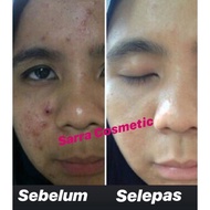 Sarra Cosmetics Free 2 item (lipstick collegen dan sabun collegen)