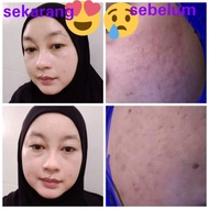 FLASHH SKINCARE PERLIS