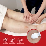 20g Edema ointment for leg swelling and muscle swelling ointment Leg swelling relief cream - Cream f