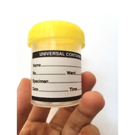 Urine Specimen Bottle 1's