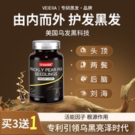 2025新款根源黑发Velella美国乌发养发护发中老年人黑发专用B族Roots Black Hair Velella American Black Hairyikaishi8888my2025092
