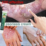 medicine for itchy skin eczema cream psoriasis cream anti itch eczema relief medicine for itchy shel