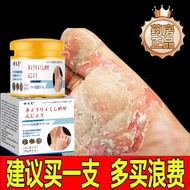 Japan Imported Foot Cream Dedicated Anti-itch Cream Fungus Infection Water Peeling Bad Foot Small Bl