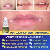 Obat Totoaeun Luka Di Sudut Bibir Pinggir Mulut Luka Angular Cheilitis Bibi Pecah Pecah Sariawan Ber