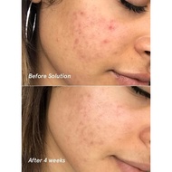 tea tree oils + active charcoal soap