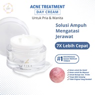 Leika Skincare Acne Cream - Pockmark Acne Cream, Acne Removal Cream, Acne and Scar Medication