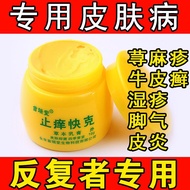 Y11 30/50g Anti-itching Crack Eczema cream Eczema cream Eczema cream Eczema cream Wind Group Anti-it