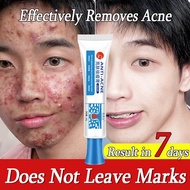 Anti-Acne Cream Pimple Scar Remover Cream Pekas Treatment Gel Skin Care Repair Marks Acne Cream 25g