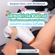 [E-voucher] Gangnam Clinic (Central Chonburi) - โปรแกรมเลเซอร์กำจัดขน Advance Diode 3 พลังงาน - บริเ