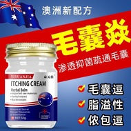 ♞◈¤ Australian ointment for treating scalp folliculitis effective scalp ringworm seborrheic dermatit