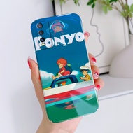 HP Feilin Acrylic Hard case Compatible For Vivo Y20 Y21 Y31 2021 Y20I Y20S Y20SG Y21S Y21A Y21T Y30 