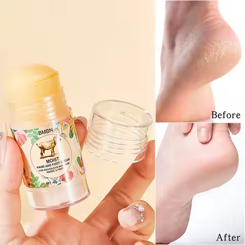 Moist Hand Foot Cream For Rough Dry Skin Deeply Repairs Cracked Skin Moisturizes Ingredient Lanolin 