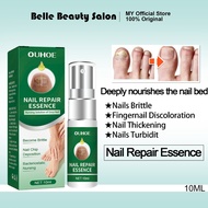 Nail Repair Spray 10ml Anti Onychomycosis Paronychia Kuku Rosak Nourishing Healthy Nail 灰指甲