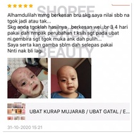 UBAT ECZEMA / UBAT GATAL / UBAT KURAP / UBAT GATAL HERBA MUJARAB