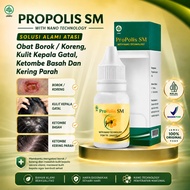 Borok Medicine Scab, Itchy Scalp, Wet and Severe Dandruff - Propolis SM