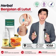 Propolis Sm Untuk Kista Baker Benjolan di Lutut Sudah Bpom dan Halal