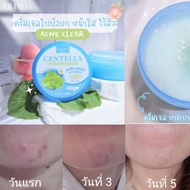 (Fast Delivery) Kihada Centella Acne Clear Gel Acne-Free 100 Grams