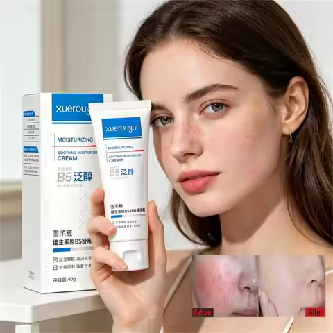 B5 Faded Facial Redness Cream Instant Spider Vein Remove Sensitive Skin Sooth Anti Redness Rosacea T