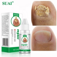 SUAI เล็บ Treatments Essence เล็บ Fungus Repair Serum Foot Care Toe Fungal Removal Gel Anti Infection Paronychia Onychomycosis