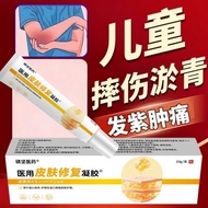 Children Bruises Under Skin Bruises Blood Bruises Hair Purple Bruises Bruises External Use Cream Reh