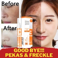 VC Whitening Freckle Cream Pen Krim jeragat paling berkesan menghilangkan flek hitam melasma melanin