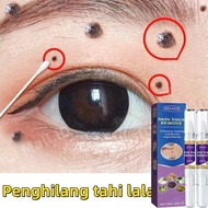 Ubat Buang Kutil ubat ketuat kutil ketuat tahi lalat biji kolestrol skin tag remover Warts removal c