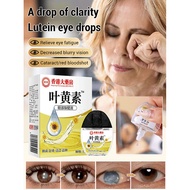 nutrient Eye Drops Eye Care Solution retinal protection Natural plant extracts Eye Care Solution Eye