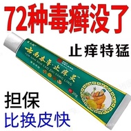 [Yunnan Anti-Itch Cream]Special Effect Itch Relief Fast Itch Relief Skin Itching External Use Dry It