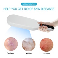 2026 High quality 311nm UVB Vitiligo Psoriasis Skin Device Narrow Band Ultraviolet Phototherapy Lamp
