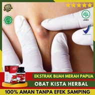 Solusi Pemecah Kista Benjolan Kelenjar Kista Ganglion Kista Cokelat Obat Kista Alami Benjolan Di Rah