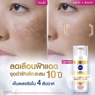 NIVEA นีเวีย ลูมินัส 630 สปอตเคลียร์ อินเทนซีฟ ทรีทเม้นท์ เซรั่ม 30 มล. (ลดฝ้าแดด เซรั่ม)