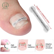 [Chicnest] 2Pcs Ingrown Toenail Corrector Tools Pedicure Recover Embed Toe Nail Professional Ingrown