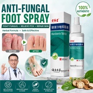 Anti-Fungal Athlete's Foot Spray Herbal Foot Spray Itchy Foot Peeling Anti-Sweat Fights Fungal Infec