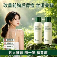 SXCS Acne-Clearing Skin-Renewing Body Spray For Men Women, Back Chest Acne Scar Removal Serum Oil Co