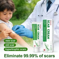 Natural Plant Extract Scar Cream - For Burn & Abrasion Scars, Moisturizing & Softening