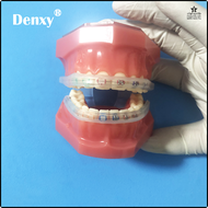 [zior] 3bags Orthodontic Braces Mouth Protector Guard Comfort Lip Bumpers Comfort Lip Shield Mouth G