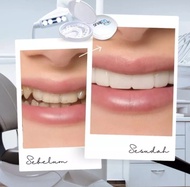 KUAT DI PAKAI MAKAN 1 Set Gigi Palsu Instan Atas Bawah Gigi palsu