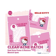 Ready (NEW)Pipiqiu Clear Acne Patch Original|Hello kitty clear acne patch original|Pipiqiu acne patc