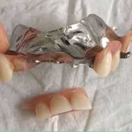 Movable Denture Glue Denture Peeling Sticky Tooth Breaking Denture Fixing Repair Denture Adhesive Movable Denture Glue Denture Peeling Sticky Tooth Breaking Denture Fixing Repair Denture Adhesive 422